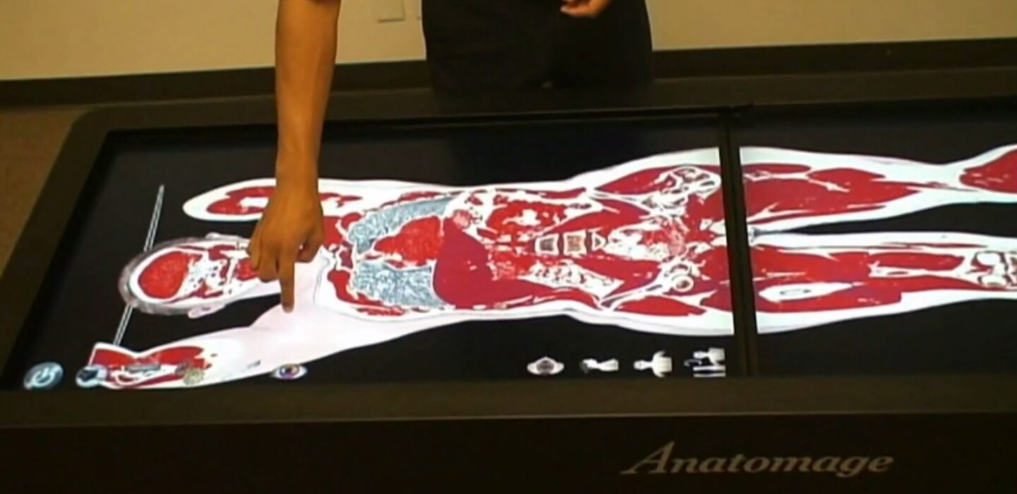 Virtual Dissection Table Shows Future of Medical Education